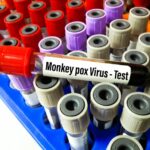 News Picture: 9 Monkeypox Cases Confirmed in United States