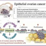 Vitamin D may restore the body’s natural barrier against ovarian cancer