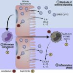 Immunologists identify critical immune cell target to treat COVID-19 complications