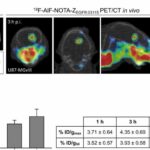 Light-activated ‘photoimmunotherapy’ could enhance brain cancer treatment