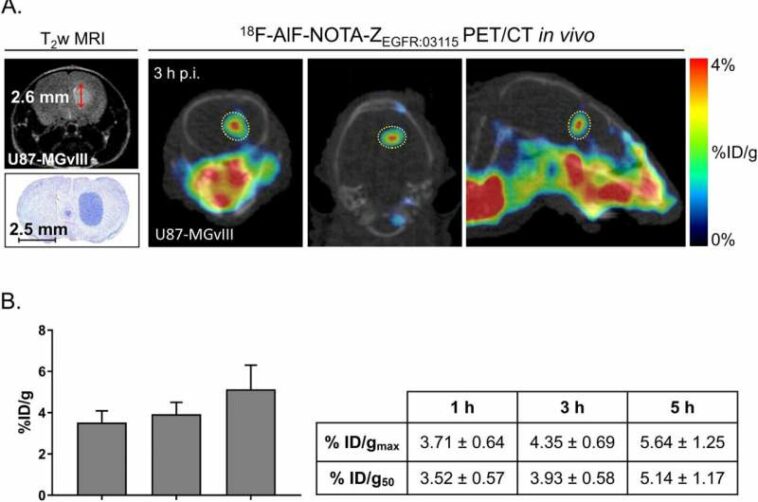 Light-activated ‘photoimmunotherapy’ could enhance brain cancer treatment