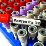 Monkeypox cases rising slowly in the U.S., CDC says