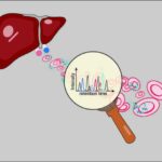 New method for early diagnosis of liver diseases by proteomics