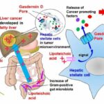 Porous cells lead to poorer livers