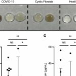 Scientists decipher the danger of gummy phlegm in severe COVID-19