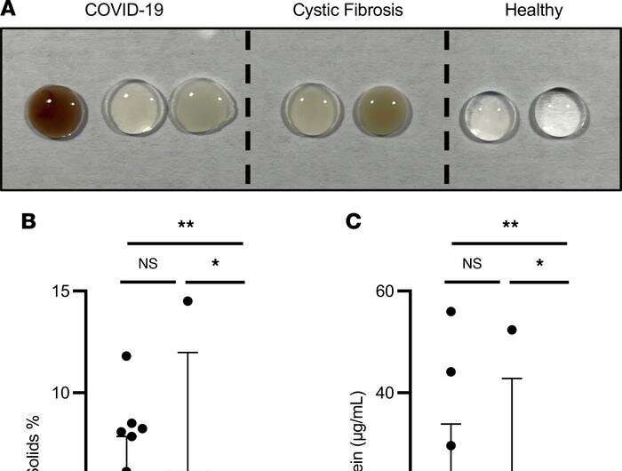 Scientists decipher the danger of gummy phlegm in severe COVID-19