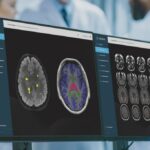 St Vincent's Hospital Sydney to deploy SNAC's AI diagnostic solutions