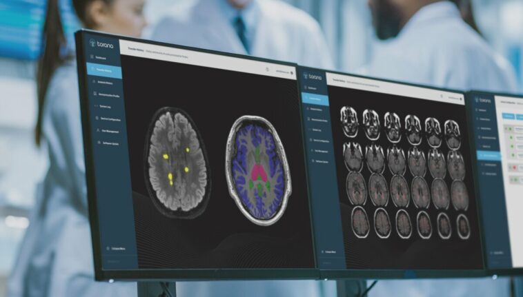 St Vincent's Hospital Sydney to deploy SNAC's AI diagnostic solutions