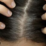 premature hair greying