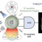 An artificial intelligence probe help see tumor malignancy