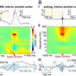 Brain ripples may help bind information across the human cortex