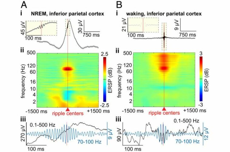 Brain ripples may help bind information across the human cortex