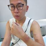 Jonathan Kan said he was attacked and verbally abused by Cypriot police in September 2021 due to his ethnicity - with the ordeal leaving him with PTSD and £7,000 in debt. Pictured: Mr Kan holds up his arm showing injuries to his arm and wrist