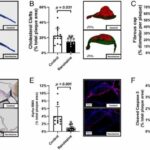 Established drug for symptoms of angina pectoris also protects vascular system