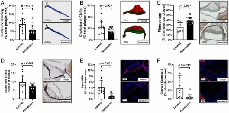 Established drug for symptoms of angina pectoris also protects vascular system