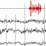 Hidden Consciousness Detected with EEG Predicts Recovery of Unresponsive Patients