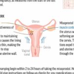 Medication abortion is common; here's how it works