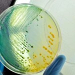 Mystery Listeria Outbreak in 10 States, 1 Death, 22 Hospitalized