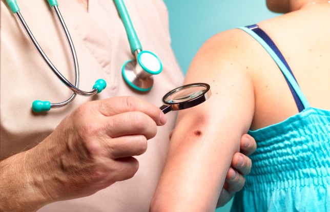 Doctor examining woman with melanoma