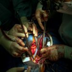 Researchers Are Hopeful Of Success Of Pig Heart Transplants In Humans Following Latest Experiment