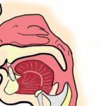 sinuses