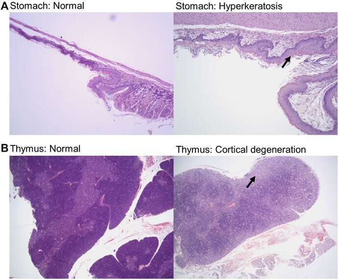 Researchers test drug combination as means to prevent drug resistance in cancer cells