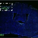 Scientists find molecular clues behind acute and chronic phases of traumatic brain injury