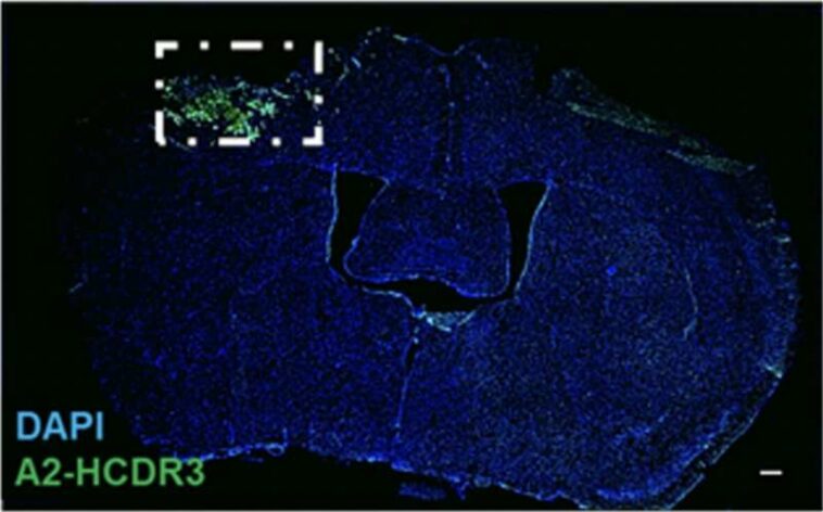 Scientists find molecular clues behind acute and chronic phases of traumatic brain injury