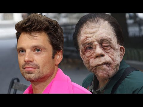 Sebastian Stan UNRECOGNIZABLE While Filming ‘A Different Man’