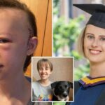 pictures of a Student with brain cancer who was given just 12 months to live and has celebrated her graduation four years on