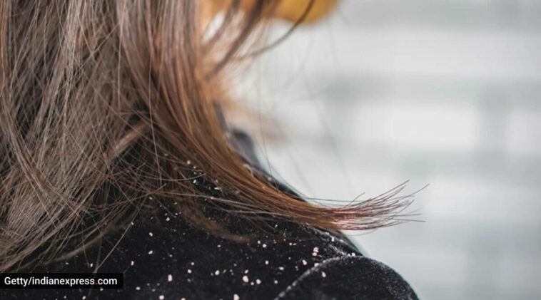 Dandruff