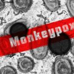 monkeypox