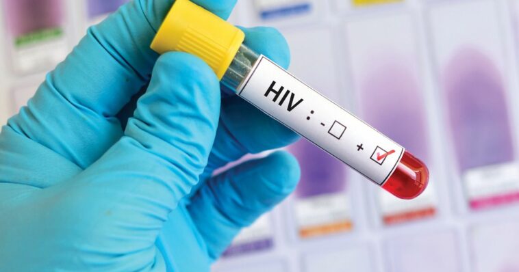 AMA launches initiative to increase HIV, STI screenings