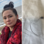 (L) Rachel Fairburn at the beach, (R) a clump of hair