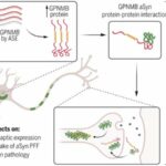 Increased concentrations of GPNMB in blood samples could be biomarker for Parkinson’s disease