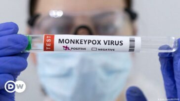 Monkeypox: US declares public health emergency