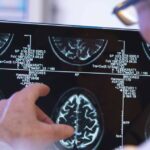 Nuance and Covera launch radiology-focused Quality Care Collaborative