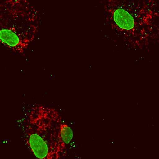 Scientists find surprising link between mitochondrial DNA and increased atherosclerosis risk