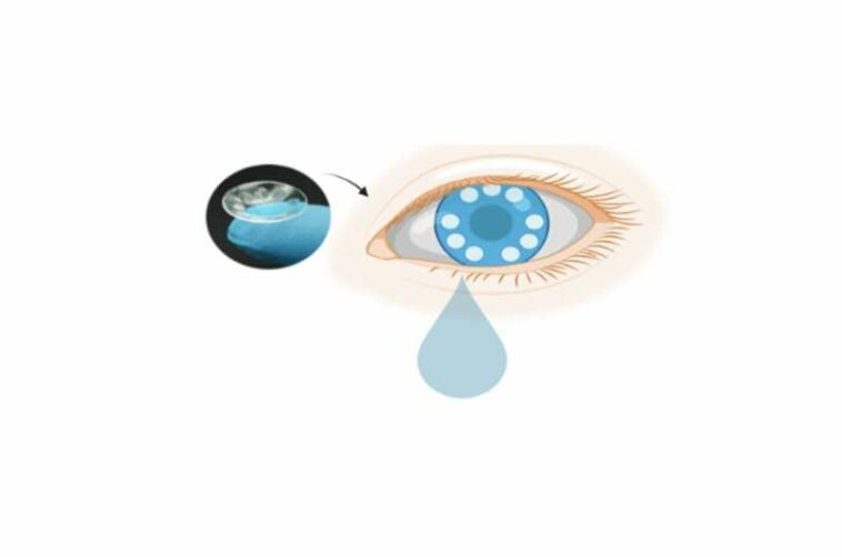 Smart contact lenses for cancer diagnostics and screening