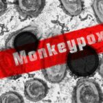 monkeypox