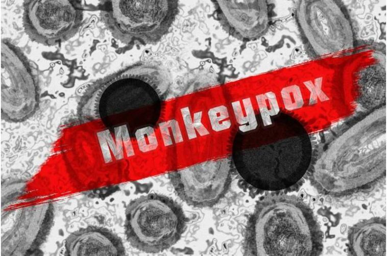 monkeypox