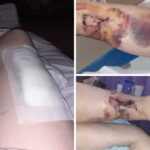 Woman calls for law change after being viciously savaged by 'frenzied' dog