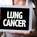 World Lung Cancer Day: ‘Tobacco damages lung tissue, smokers over 50 must get scans’