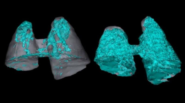 Disarming the immune system's lethal lung response