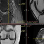 New free software enables 3D image sharing in PACS