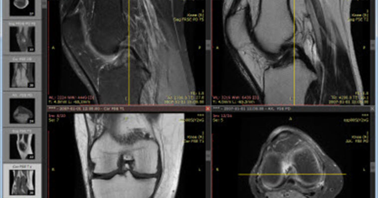 New free software enables 3D image sharing in PACS