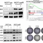 Overexpressed Cyclin D1 and CDK4 proteins are responsible for the resistance to CDK4/6 inhibitor in breast cancer that can be re