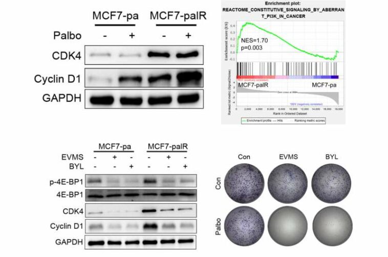 Overexpressed Cyclin D1 and CDK4 proteins are responsible for the resistance to CDK4/6 inhibitor in breast cancer that can be re