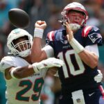 Pats' Jones suffers back injury, undergoes X-rays