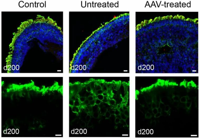 NIH researchers develop gene therapy for rare ciliopathy